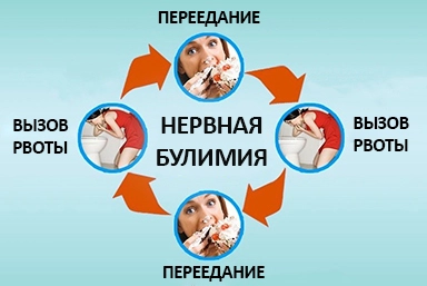 Лечение булимии в Бугульме